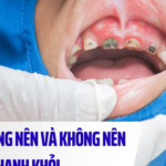 Nhiệt miệng nên ăn gì và kiêng gì để nhanh khỏi?