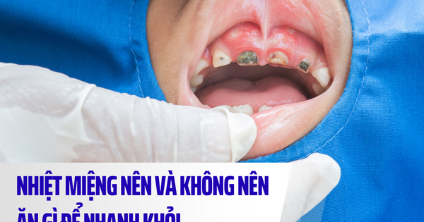 Nhiệt miệng nên ăn gì và kiêng gì để nhanh khỏi?