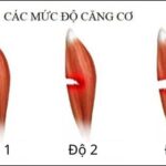 Bài tập thư giãn cho người căng cơ quá mức