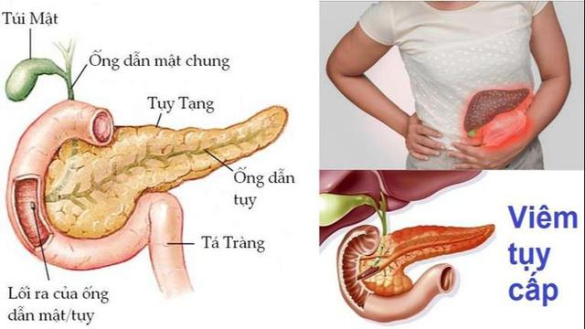 Một người đàn ông ở Phú Thọ nhập viện vì mỡ máu cao gấp 50 lần bình thường, bác sĩ khuyên nên từ bỏ ngay thói quen này - Ảnh 2.