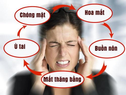 Phải làm gì với chứng rối loạn tiền đình ở người trẻ? - Ảnh 1.