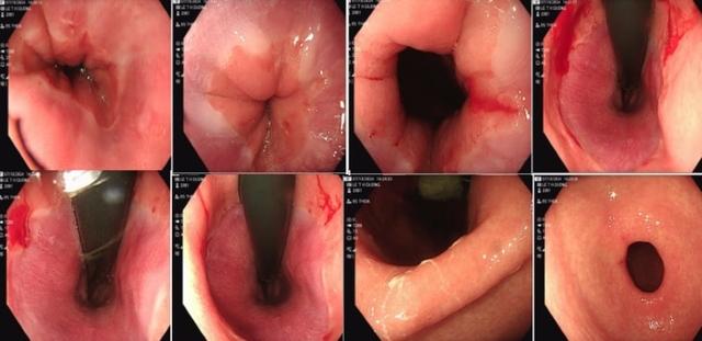 Cô gái 23 tuổi ở Hải Dương nôn ra máu, được đưa vào bệnh viện, thừa nhận hành vi này trong bữa tiệc - Ảnh 2.