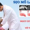 Sản phụ 40 tuổi ở Củ Chi nhập viện gấp vì thai bám ở sẹo mổ nguy hiểm