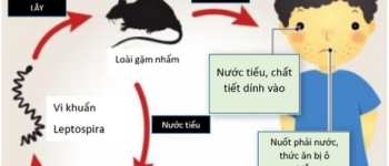 Sốt cao liên tục, 2 trẻ nhập viện trong tình trạng nặng vì nhiễm loại xoắn khuẩn nguy hiểm