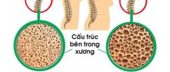 Mối nguy hiểm tiềm ẩn khi phụ nữ thiếu canxi