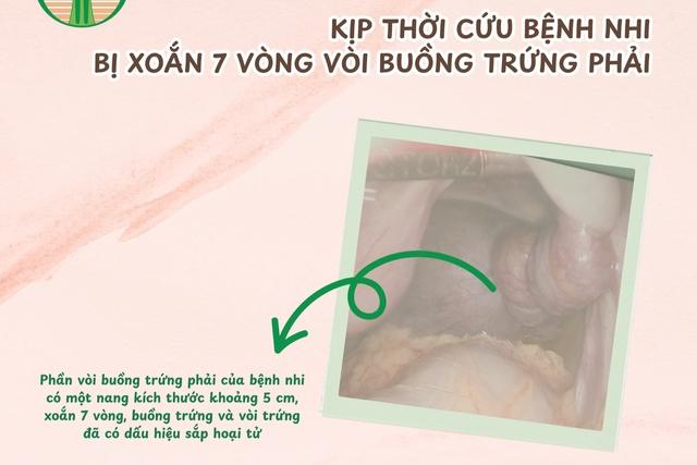 Bé trai 13 tuổi ở Bình Dương suýt bị hoại tử buồng trứng do dấu hiệu nhiều người Việt bỏ qua - Ảnh 2.