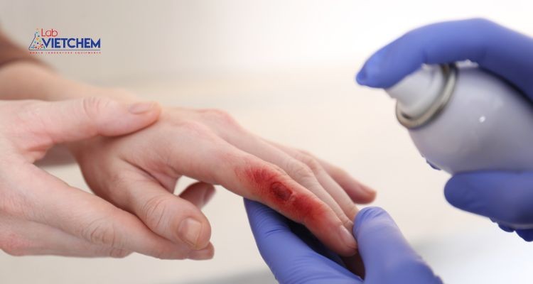 Bỏng da do hóa chất