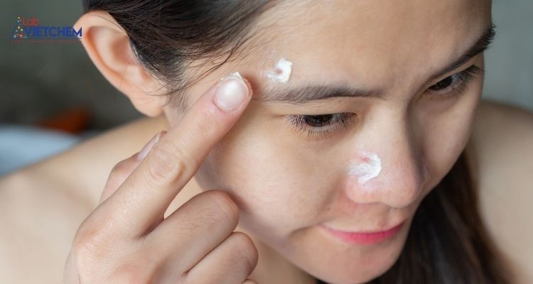 Axit Succinic có đặc tính chống viêm