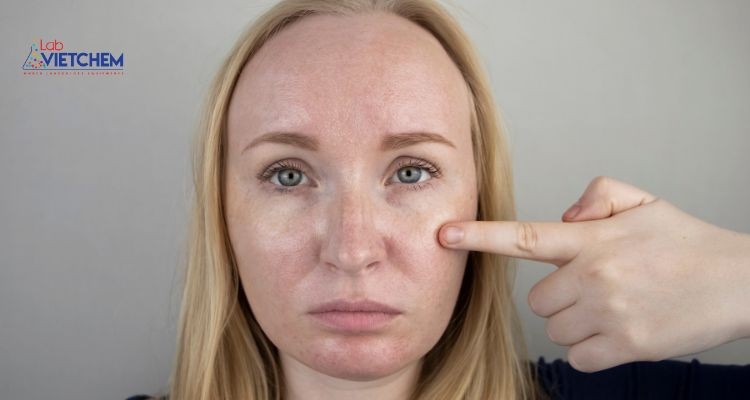 Dimethicon có thể làm tắc nghẽn lỗ chân lông