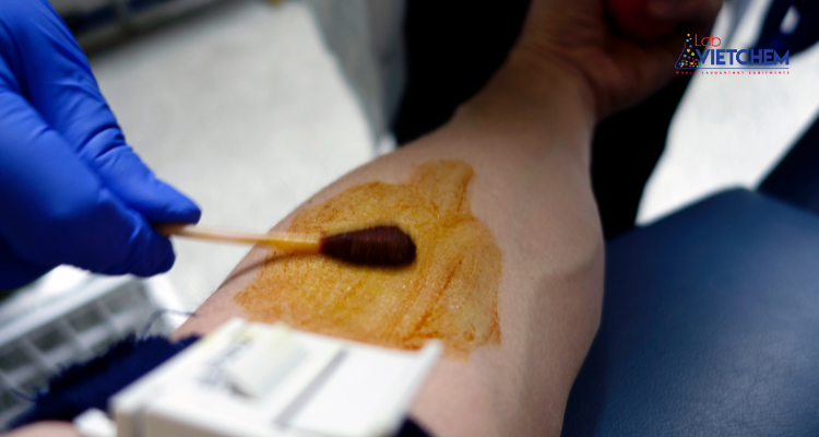 Rượu iốt khử trùng da