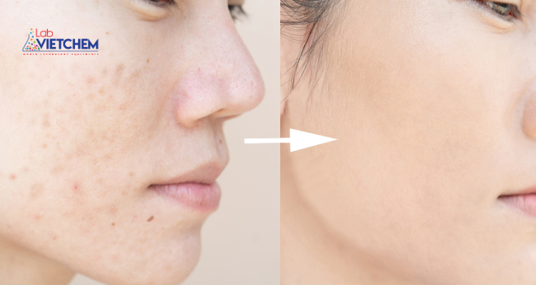 Bentonite giúp loại bỏ bụi bẩn và se khít lỗ chân lông