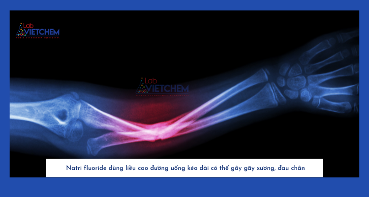 Dùng NaF liều cao trong thời gian dài có thể làm tăng nguy cơ gãy xương