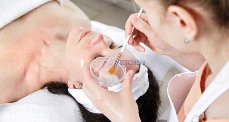 Axit salicylic nồng độ 0,5% dùng để lột da 