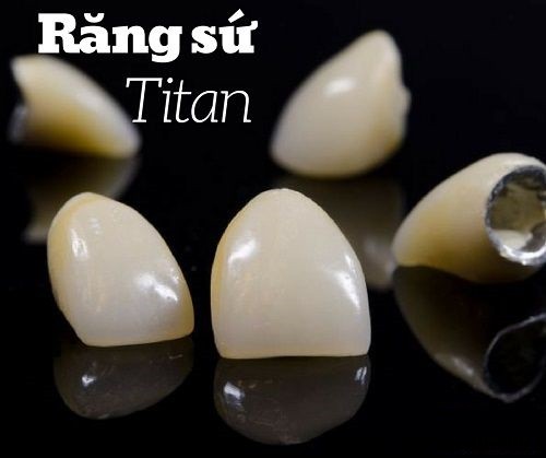 Chân răng giả làm bằng titan