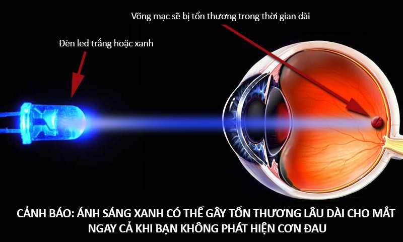 Võng mạc của mắt bị tổn thương do ánh sáng xanh