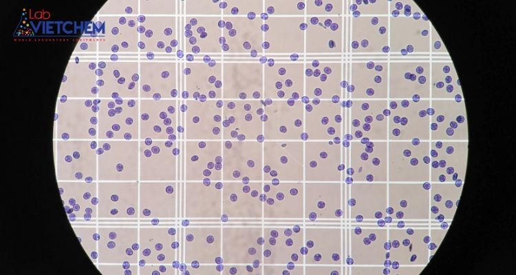 Buồng đếm hồng cầu là phương pháp xác định tổng số nhóm vi sinh vật