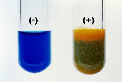 Định nghĩa: Thuốc thử Fehling là gì?